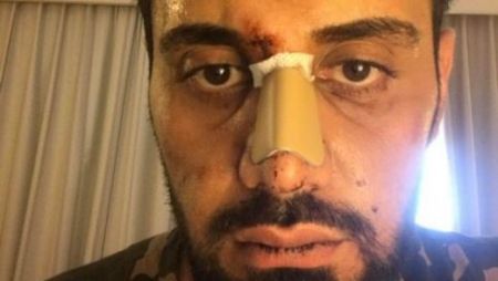 Τουρίστας καταγγέλλει ρατσιστική επίθεση και διακρίσεις από τις Αρχές