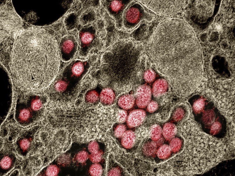 Κορωνοϊός: Ανακάλυψη επιστημόνων γεννά ελπίδες στη μάχη κατά της πανδημίας
