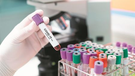 Πρωτοποριακά διαγνωστικά τεστ με ελληνική υπογραφή