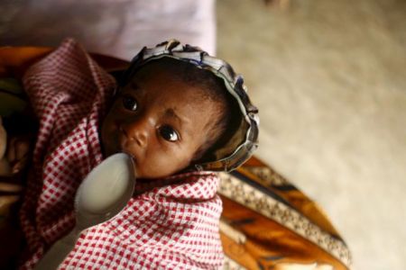 ΟΗΕ : Ο κορωνοϊός αυξάνει κατά 10.000 μηνιαίως τους θανάτους παιδιών από υποσιτισμό
