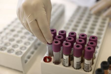 Κορωνοϊός : Οι διευκρινίσεις Μαγιορκίνη για τις νέες έρευνες σχετικά με την ομάδα αίματος
