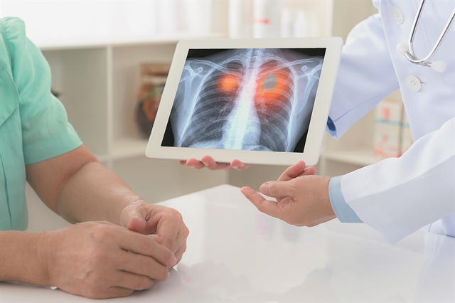 Η έγκαιρη διάγνωση του καρκίνου του πνεύμονα σώζει ζωές