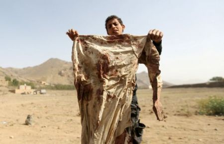 Υεμένη : Τουλάχιστον πέντε γυναίκες σκοτώθηκαν από ρουκέτα σε γαμήλιο γλέντι