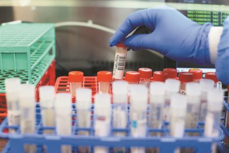 Ελληνικό τεστ ταχείας ανίχνευσης του ιού