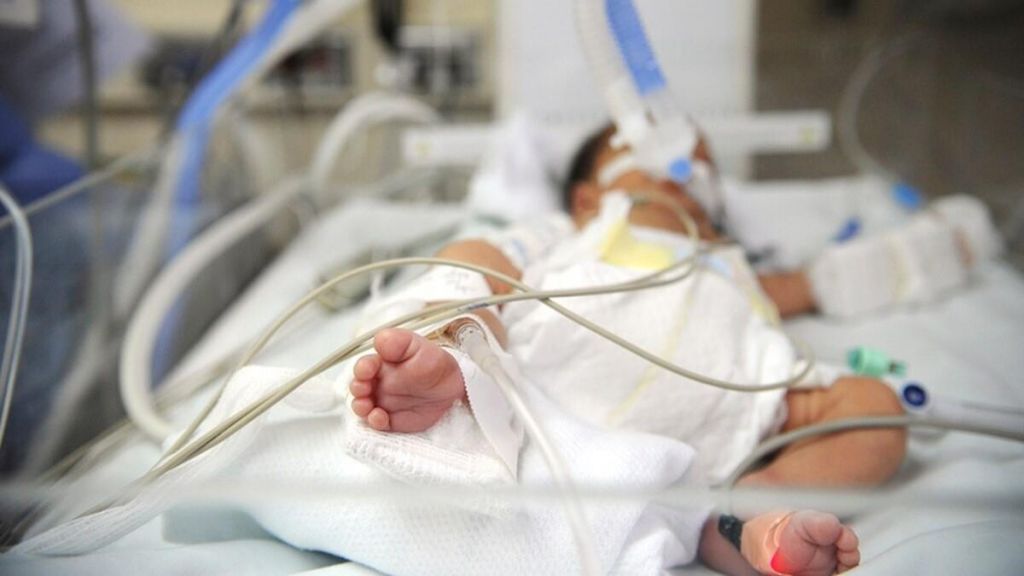 Κικίλιας : Η συγκίνηση για το βρέφος 24 ημερών που νοσηλεύεται διασωληνωμένο με κορωνοϊό