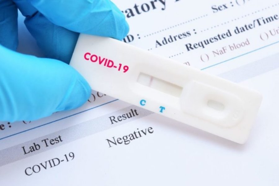 Σκέρτσος : Δωρεάν τεστ κορωνοϊού για όλους κάθε εβδομάδα από τα φαρμακεία