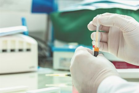 Οι επιπτώσεις της πανδημίας στη φροντίδα ασθενών με HIV