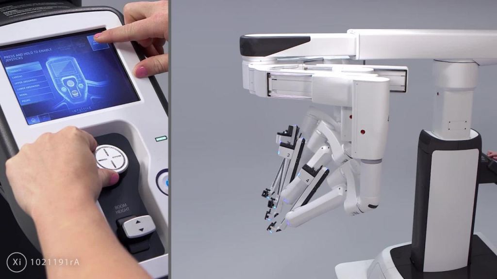 Robotic Assisted Thoracic Surgery (RATS): Η εξέλιξη της Ρομποτικής Θωρακοχειρουργικής στην υπηρεσία του ασθενούς