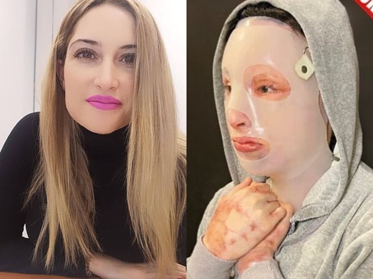 Επίθεση με βιτριόλι : «Δεν δέχομαι καμία συγγνώμη» απαντά η Ιωάννα στην 35χρονη | tovima.gr