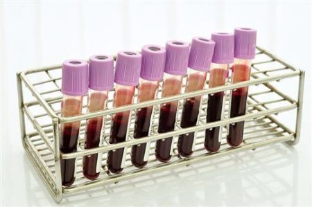 Κορωνοϊός : Δεν φαίνεται να σχετίζεται η ομάδα αίματος με την πιθανότητα λοίμωξης