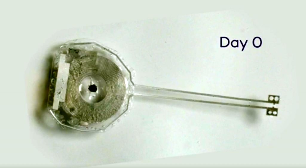 Βηματοδότης διαλύεται μόνος του όταν είναι αχρείαστος