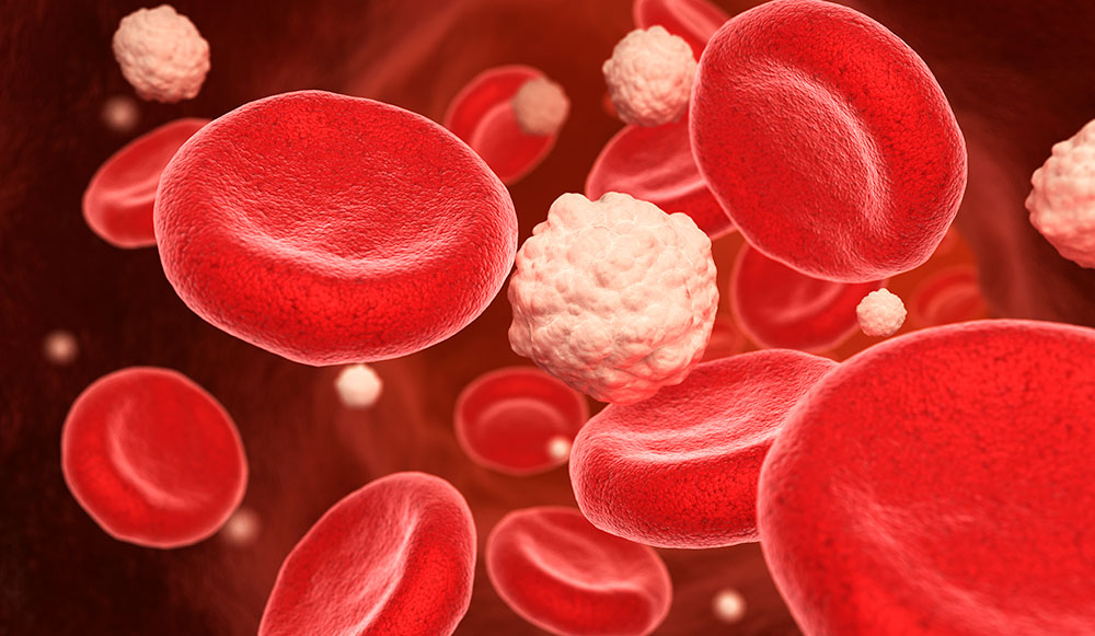 Αυξημένη γλυκόζη οδηγεί σε βαρύτερη ασθένεια από κορωνοϊό