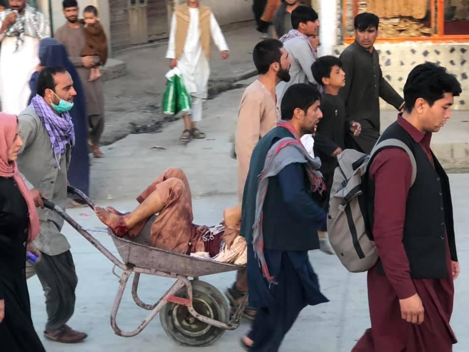 Αφγανιστάν – 60 τραυματίες σε νοσοκομείο ιταλικής ΜΚΟ – Με παγιδευμένο αυτοκίνητο η δεύτερη έκρηξη