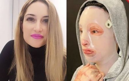 Ιωάννα Παλιοσπύρου – Δημοσίευσε ανατριχιαστικές φωτογραφίες μετά την επίθεση με το βιτριόλι