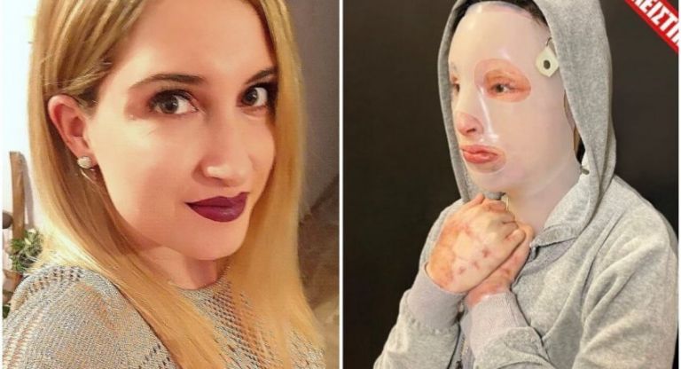 «Θα πάω στη δίκη – Θέλω να με κοιτάξει όπως όταν έριξε το βιτριόλι» – Συγκλονίζει η Ιωάννα