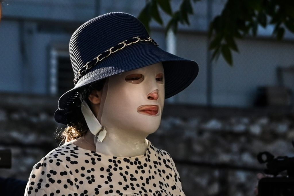 Επίθεση με βιτριόλι – Κατέθεσε ο 40χρονος – Η σχέση του με την κατηγορούμενη – «Δεν γνώριζα την Ιωάννα»