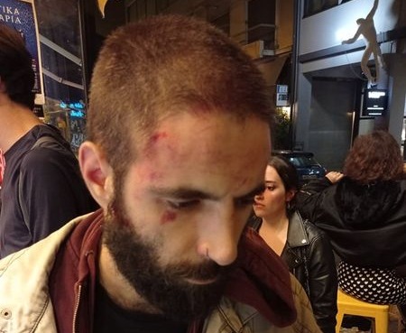 Φασιστική επίθεση σε μέλος του ΣΕΚ στου Ψυρρή | tovima.gr