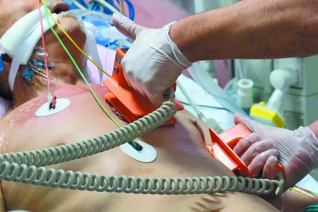 Οικονόμου – Μόνο υγειονομικά τα κριτήρια για την εισαγωγή στις ΜΕΘ