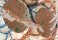 Τριπλός συνδυασμός φαρμάκων δίνει «ανάσα» σε ασθενείς με κυστική ίνωση