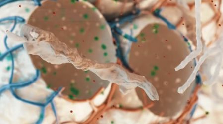 Τριπλός συνδυασμός φαρμάκων δίνει «ανάσα» σε ασθενείς με κυστική ίνωση