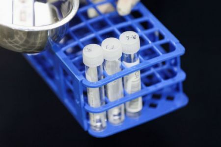 Κορωνοϊός – Επιστήμονες εντόπισαν «κρυφή» εκδοχή της Όμικρον που δεν ανιχνεύεται με μοριακά τεστ