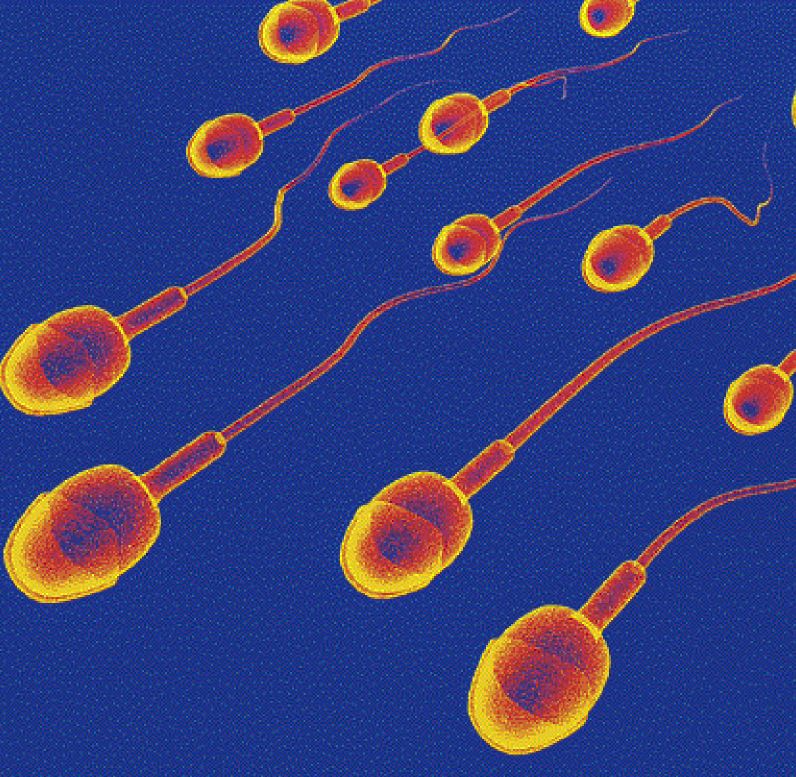 Έρευνα –  Το ανδρικό σπέρμα μπορεί να έχει χειρότερη ποιότητα για λίγους μήνες μετά από λοίμωξη Covid-19