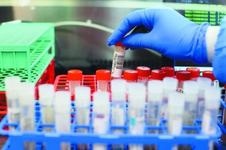 Όμικρον – Οι ΗΠΑ παγώνουν τη θεραπεία της Regeneron που χρησιμοποιείται και στην Ελλάδα