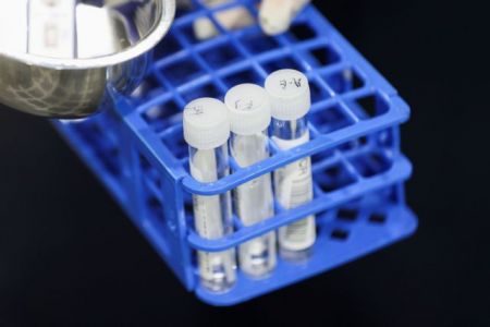 Παραλλαγή Όμικρον: Γιατί μερικά rapid test εμφανίζονται «ψευδώς αρνητικά»; – Οι οδηγίες των ειδικών και το τσουχτερό κόστος των PCR