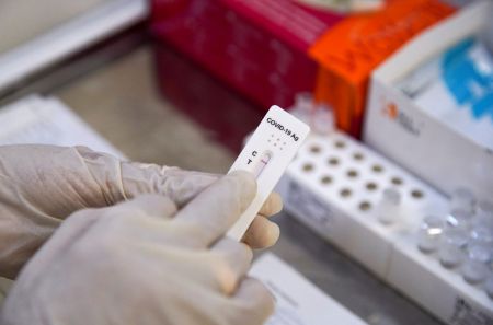 Κορωνοϊός – Νέα σύσταση: Δεν χρειάζεται και μοριακό τεστ μετά από θετικό rapid test