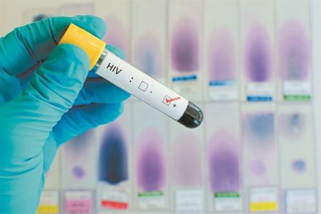Οι εξελίξεις στη θεραπεία  της HIV λοίμωξης