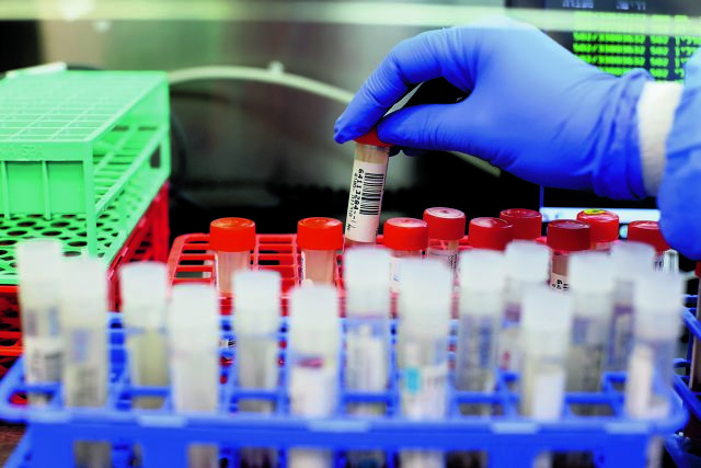 Κορωνοϊός – Πώς επιτίθεται στο ανθρώπινο σώμα – Τι αποκαλύπτει νέα έρευνα