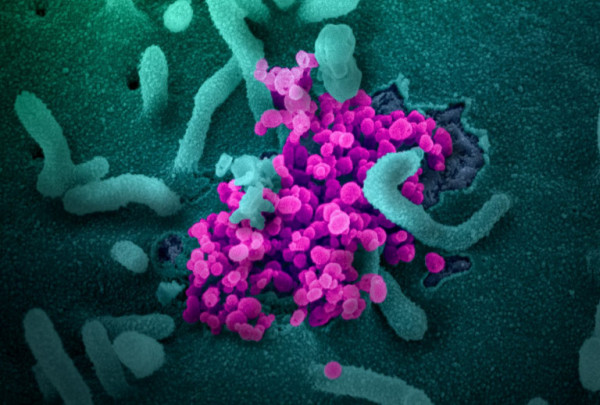 Μονοκλωνικά αντισώματα – Δεν είναι αποτελεσματικά έναντι της Όμικρον – Αποσύρονται στις ΗΠΑ