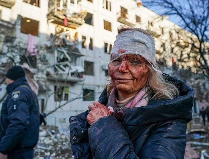 Ουκρανία: H φωτογραφία με την τραυματισμένη γυναίκα που συγκλονίζει τον πλανήτη