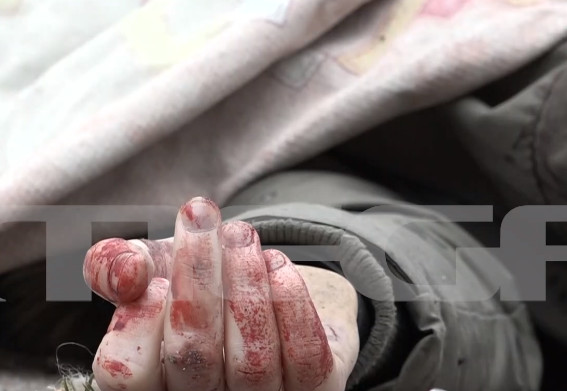 Πόλεμος στην Ουκρανία: Το MEGA στον βομβαρδισμό του Ιρπίν – Αποκλειστικό βίντεο που «παγώνει» το αίμα