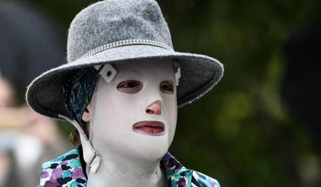 Ιωάννα Παλιοσπύρου: Τι λέει η γιατρός της για τις επιπλοκές του τελευταίου χειρουργείου