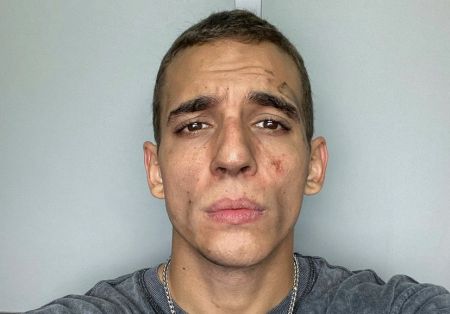 Κάηκε στο σπίτι του «Ρίο» από το «La Casa de Papel» – Πήδηξε από το παράθυρο για να σωθεί