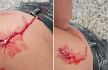 ΚΕΕΡΦΑ: Φασίστες μαχαίρωσαν μετανάστη στον Κόκκινο Μύλο