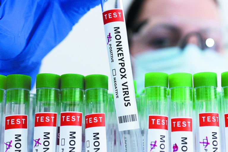 «Η ευλογιά των πιθήκων δεν είναι COVID-19» – Κορυφαίος σύμβουλος του ΠΟΥ εξηγεί στο ΒΗΜΑ