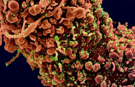 Κορωνοϊός: Συχνή η διαταραχή του ύπνου και η κόπωση μετά τη νόσηση