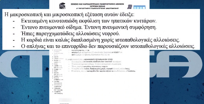 Πάτρα: Αυτό είναι το πόρισμα του παθολογοανατόμου για τη Μαλένα