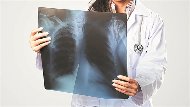 Πρόληψη για τον καρκίνο του πνεύμονα | tovima.gr