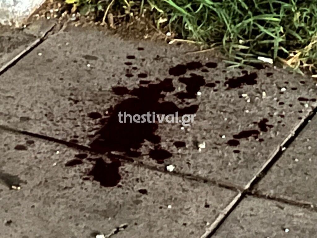 ΑΠΘ: Πυροβολισμοί με έναν τραυματία [εικόνες]