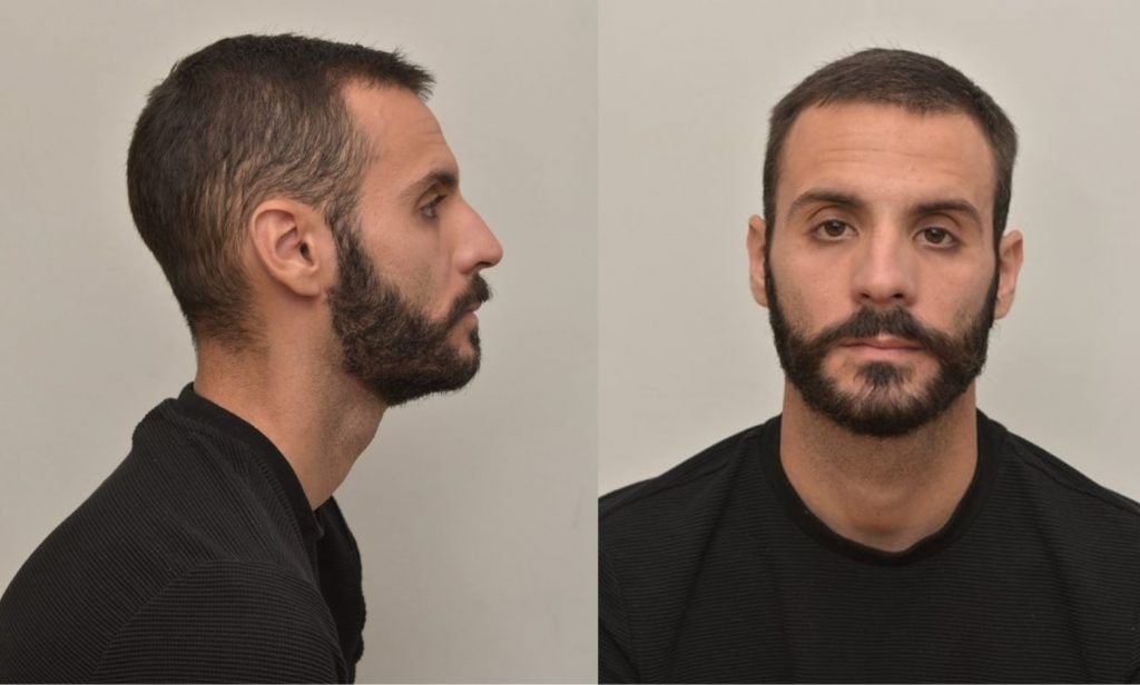 Αγρίνιο: Πού «κρύβεται» ο 28χρονος που κατηγορείται για ασέλγεια σε 4χρονο