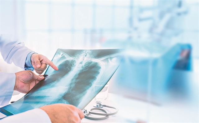 Η έγκαιρη διάγνωση σημαντικό όπλο στη μάχη κατά του καρκίνου του πνεύμονα