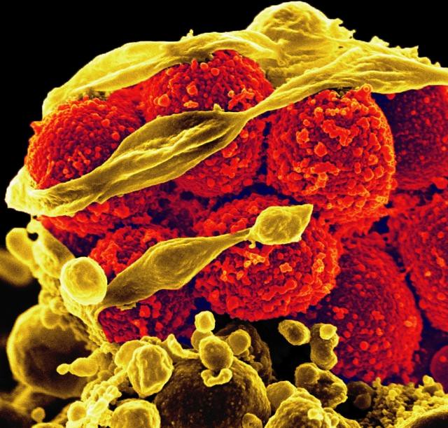 Μικροβιακή αντοχή, μία από τις 10 σοβαρότερες παγκόσμιες απειλές της ανθρωπότητας