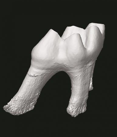 Πρόβλεψη των οδοντικών παθήσεων… από την κούνια