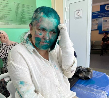 Τσετσενία: Άγρια επίθεση κατά δημοσιογράφου – Την κούρεψαν και της έσπασαν τα χέρια