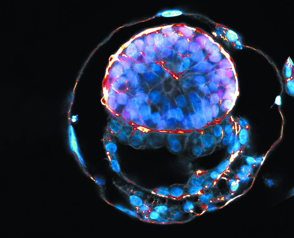 Συνθετικά ανθρώπινα έμβρυα. Απειλή ή θησαυρός;