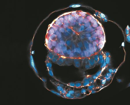 ΤΑ ΣΥΝΘΕΤΙΚΑ ΕΜΒΡΥΑ ΕΙΝΑΙ ΕΔΩ