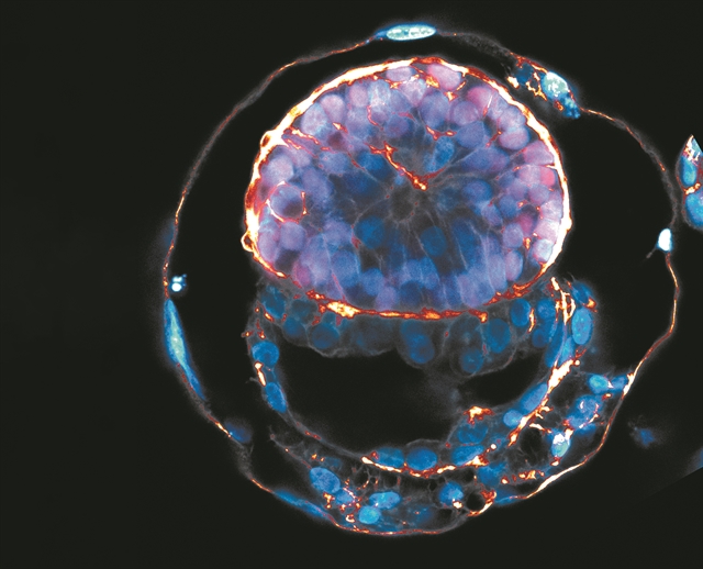 ΤΑ ΣΥΝΘΕΤΙΚΑ ΕΜΒΡΥΑ ΕΙΝΑΙ ΕΔΩ